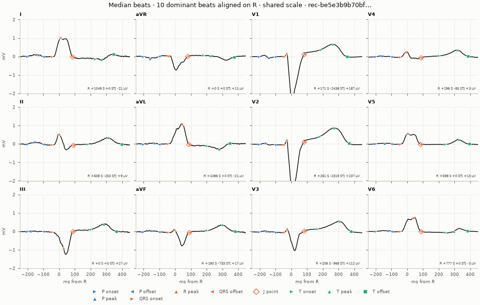 12-lead median beats