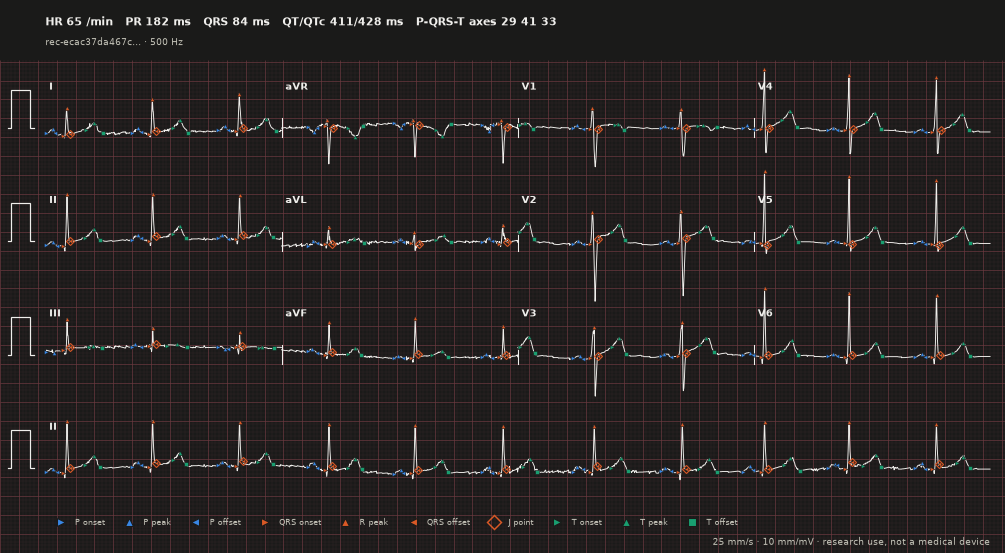 ECG paper with landmarks, dark theme